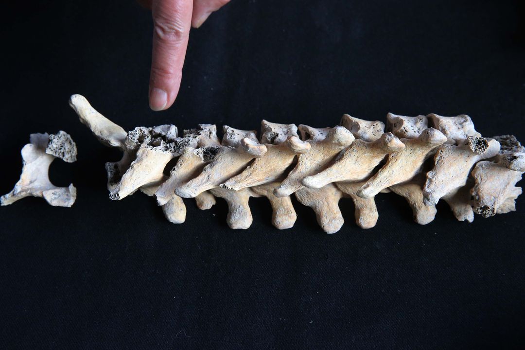 Kazılarda Bulunan İskeletlerden Antik Hastalıklar Bulunacak 2