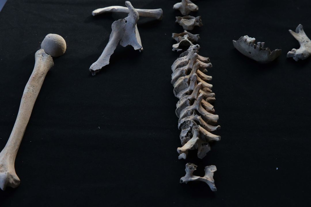 Kazılarda Bulunan İskeletlerden Antik Hastalıklar Bulunacak 20