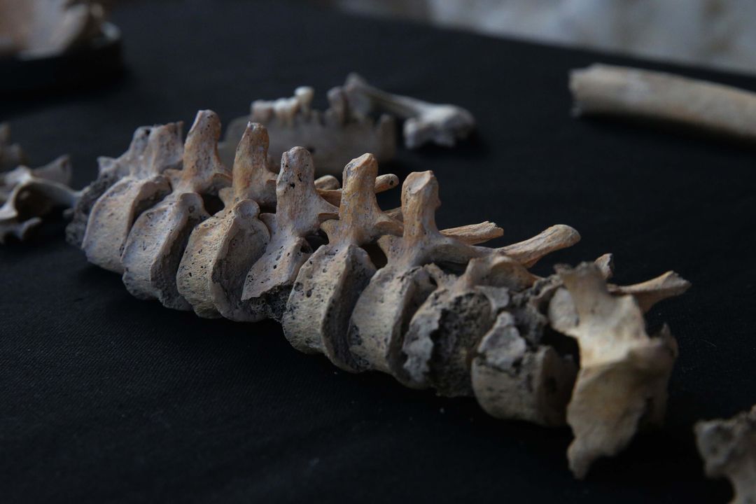 Kazılarda Bulunan İskeletlerden Antik Hastalıklar Bulunacak 16
