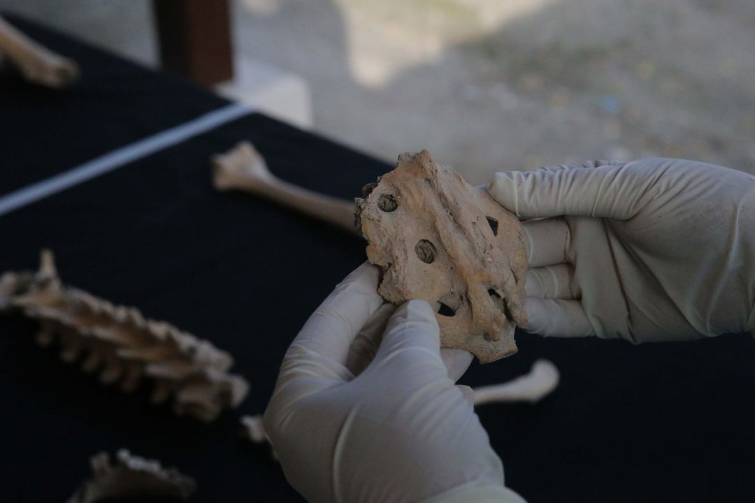 Kazılarda Bulunan İskeletlerden Antik Hastalıklar Bulunacak 13