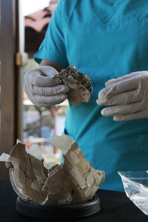 Kazılarda Bulunan İskeletlerden Antik Hastalıklar Bulunacak 15