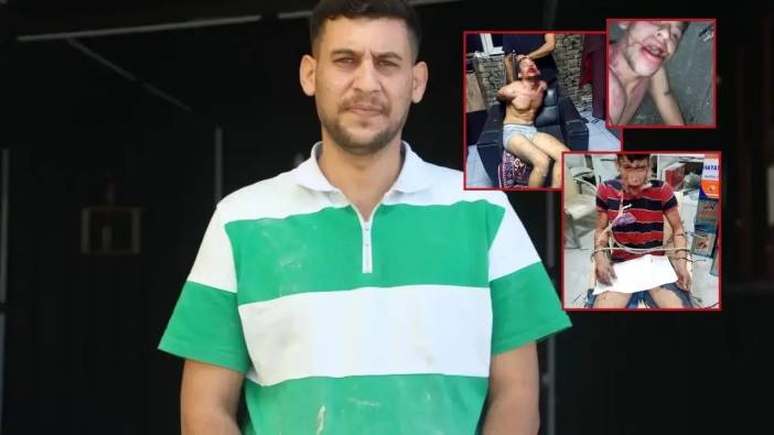 Dişleri Kırıldı, Hamam Böceği Yedirildi! Kepez'de 3 Gün İşkenceye 20'şer Yıl İstendi