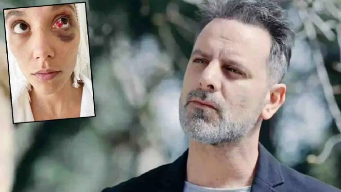 5 Yıl Süren Dava Sonuçlandı: Ozan Güven Hapse Girecek