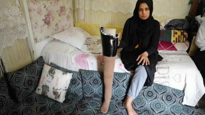 Antalya'da Yaşayan Kadın Hatay'da Depremde Bacağını Kaybetti! Eşi Terk Etti