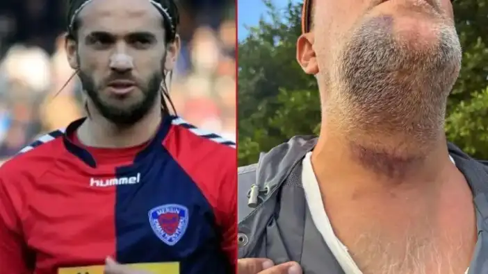 Kaş'ta Futbolcu Velisine Darp: Eski Milli Futbolcu Tahliye Edildi