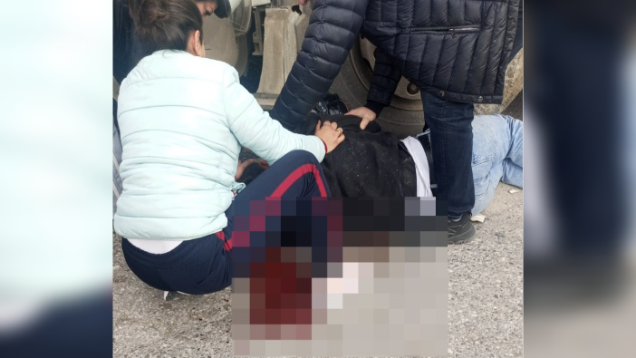 Konyaaltı'nda feci kaza: Yüzünden kopan parçayı hastaneye böyle götürdüler