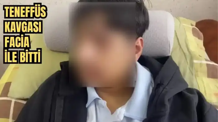 Antalya'da Okulda Akran Zorbalığı İddiası! 15 Yaşındaki Öğrencinin Çenesi Kırıldı