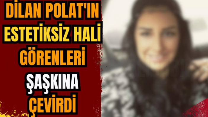 Dilan Polat'ın estetiksiz hali görenleri şaşkına çevirdi!