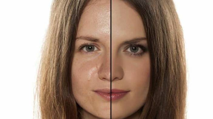 Cilt yağlanması neden olur? Yüz yağlanması nasıl önlenir?