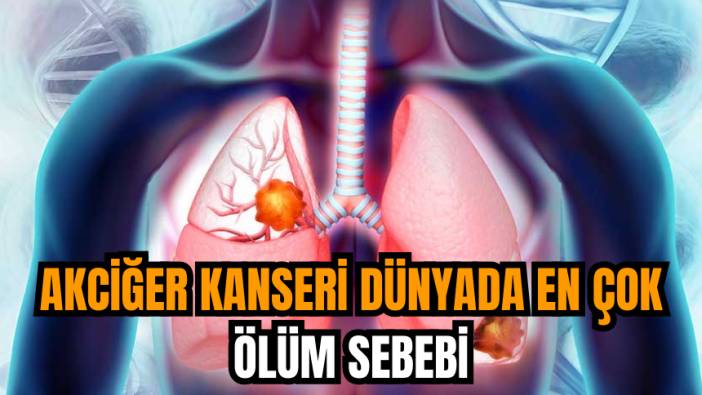 Akciğer kanseri dünyada en çok ölüm sebebi