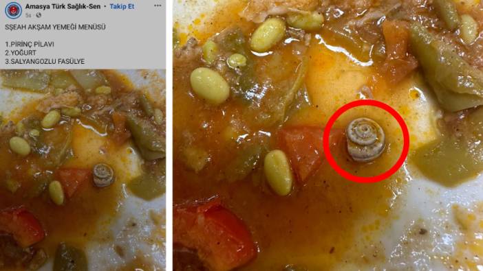 Hastanede skandal! Yemekten salyangoz çıktı iddiası