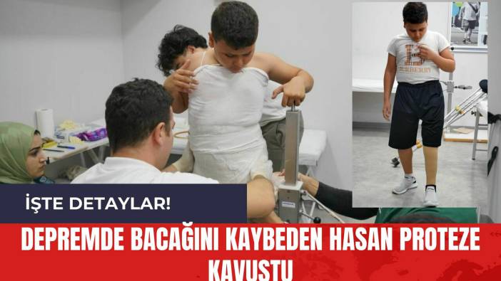 Depremde Bacağını Kaybeden Hasan Proteze Kavuştu