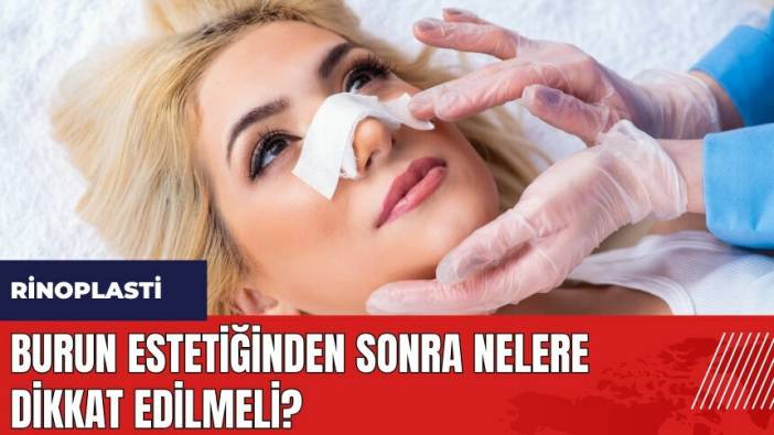 Burun estetiğinden sonra nelere dikkat edilmeli?