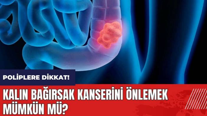 Kalın bağırsak kanserini önlemek mümkün mü?