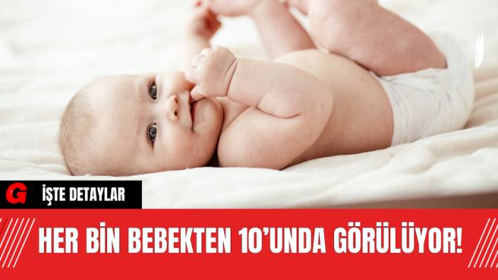 Her Bin Bebekten 10’unda Görülüyor!