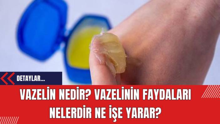 Vazelin Nedir? Vazelinin Faydaları Nelerdir Ne İşe Yarar?