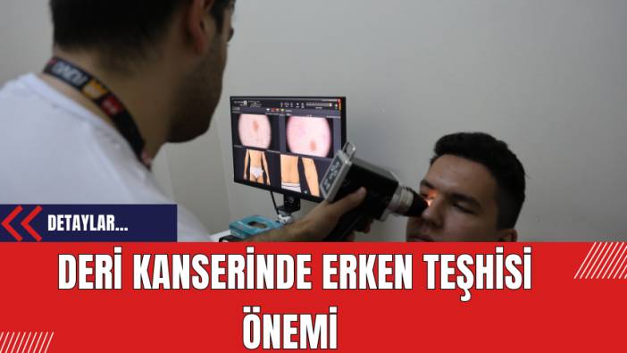 Deri Kanserinde Erken Teşhisi Önemi