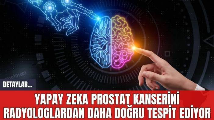 Yapay Zeka Prostat Kanserini Radyologlardan Daha Doğru Tespit Ediyor