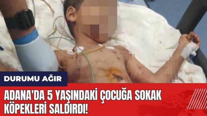 Adana'da 5 yaşındaki çocuğa sokak köpekleri saldırdı! Durumu ağır