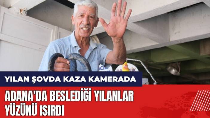 Adana'da beslediği yılanlar yüzünü ısırdı