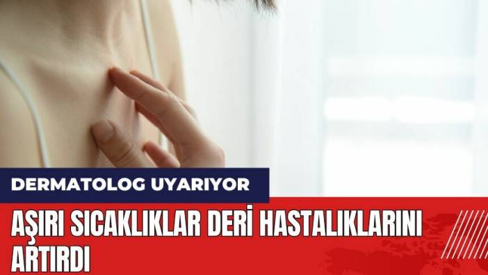 Aşırı sıcaklıklar deri hastalıklarını artırdı