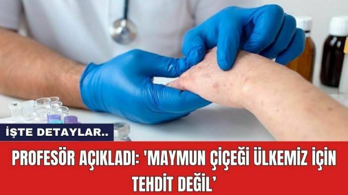 Profesör açıkladı: 'Maymun çiçeği ülkemiz için tehdit değil'
