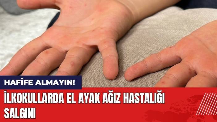 İlkokullarda El Ayak Ağız Hastalığı Salgını!