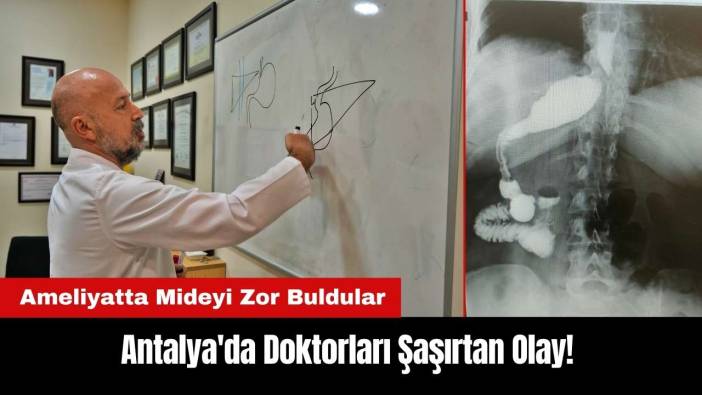 Antalya'da Doktorları Şaşırtan Olay! Ameliyatta Mideyi Zor Buldular