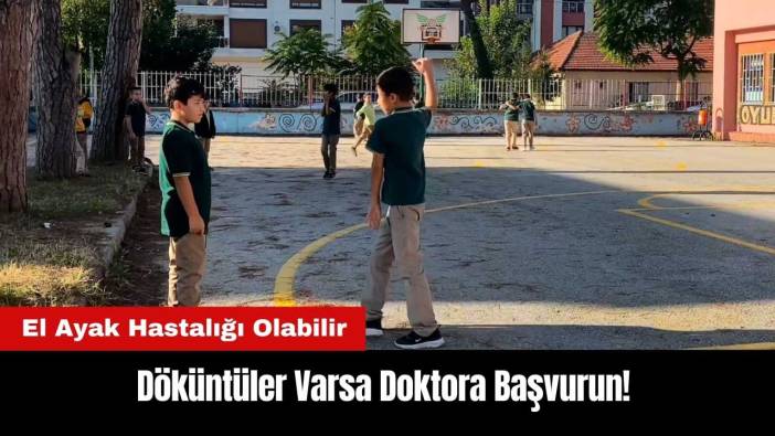 Döküntüler Varsa Doktora Başvurun! El Ayak Hastalığı Olabilir