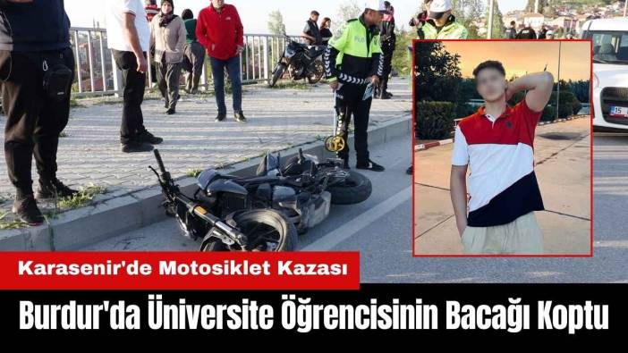 Burdur'da Spor Bilimleri Öğrencisinin Bacağı Koptu