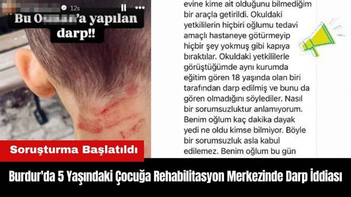 Burdur'da 5 Yaşındaki Çocuğa Rehabilitasyon Merkezinde Darp İddiası
