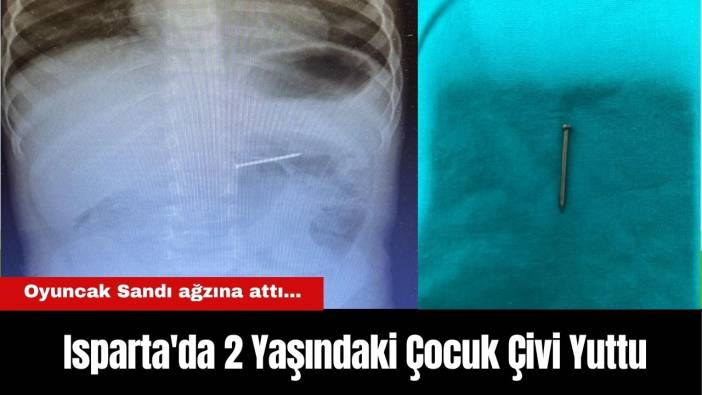 Oyuncak Sandı ağzına attı... Isparta'da 2 Yaşındaki Çocuk Çivi Yuttu