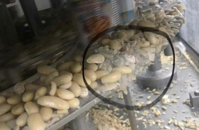 mide-bulandiran-goruntular