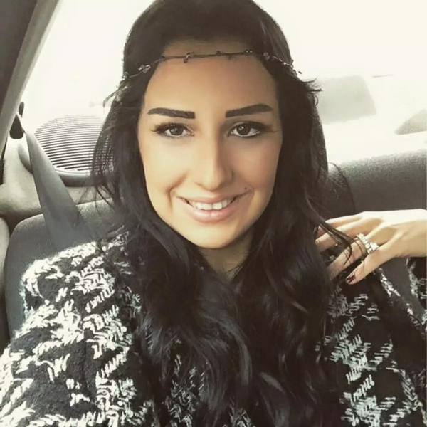 Dilan Polat'ın estetiksiz hali görenleri şaşkına çevirdi