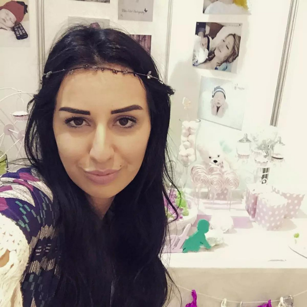 Dilan Polat'ın estetiksiz hali görenleri şaşkına çevirdi