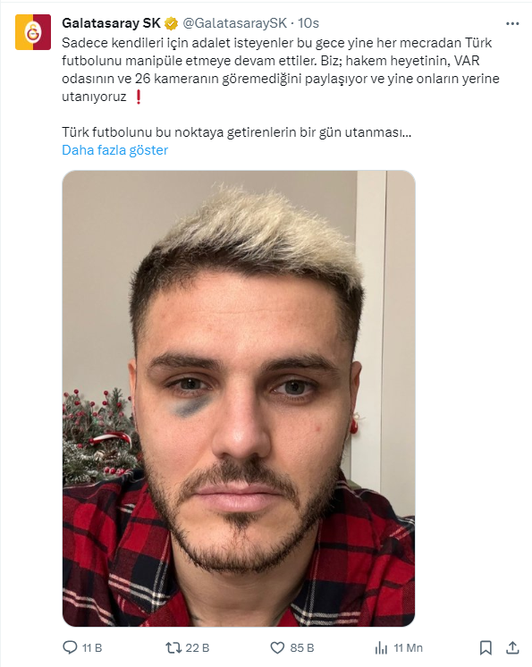 Dzeko'dan Galatasaray'a sert yanıt: 'Her zamanki halleri'