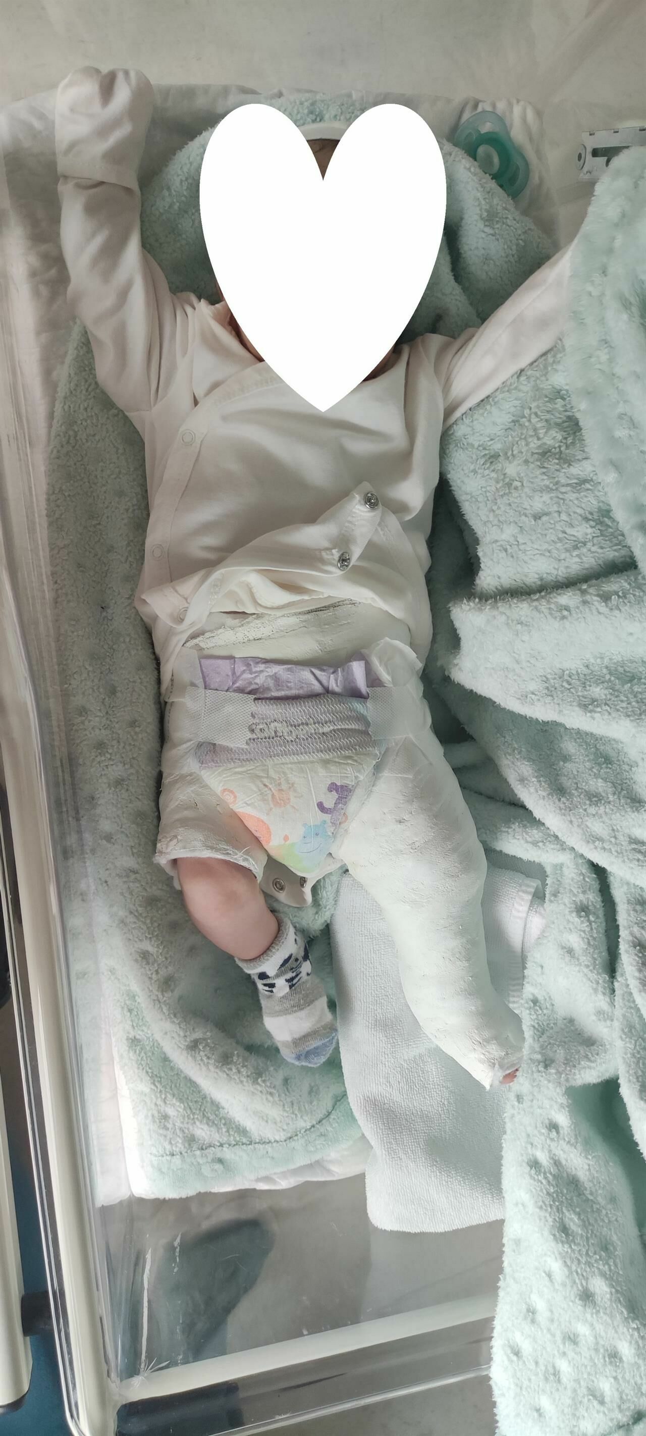 Bir aile, bir aylık bebeğinin bacağının özel bir hastanede kırıldığını iddia ediyor. 1