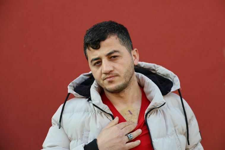 Adana'da Ilginç Saldırı! Hem Para Verdi, Hem Bıçaklandı