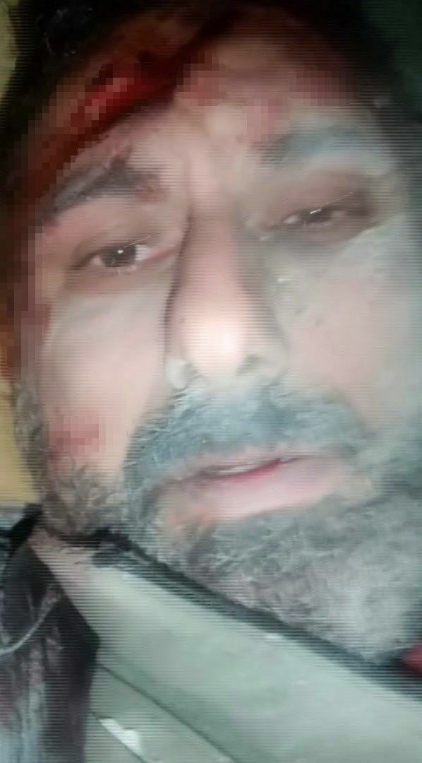 Depremde Mezardan Küçük Yerde 4 Gün Kaldı 