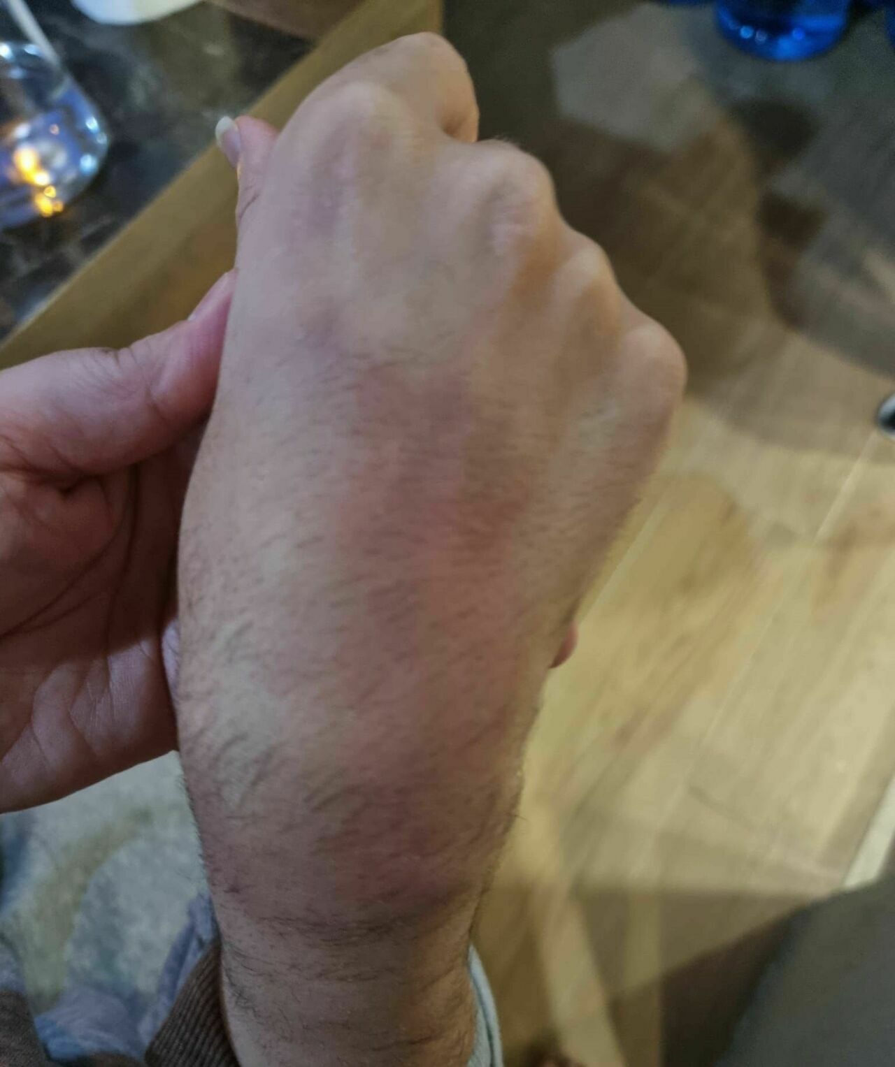 Otizmli Gence Öğretmeninden Sopalı Dayak Iddiası4