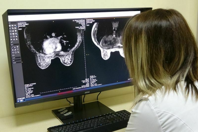 8 Kadından Biri Meme Kanseri! Uzmandan Tarama Uyarısı  (2) Result