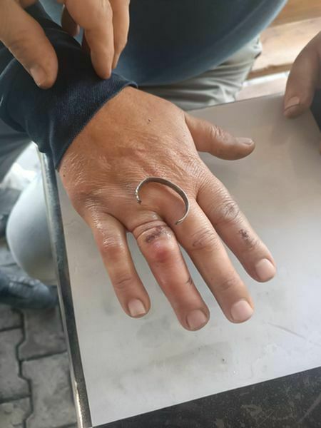 Sıkışan Yüzüğünü Itfaiye Çıkardı 3 Result