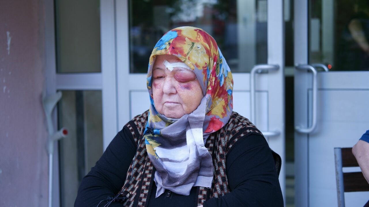 Edirne’de Başıboş Köpeklerin Saldırısına Uğradi3