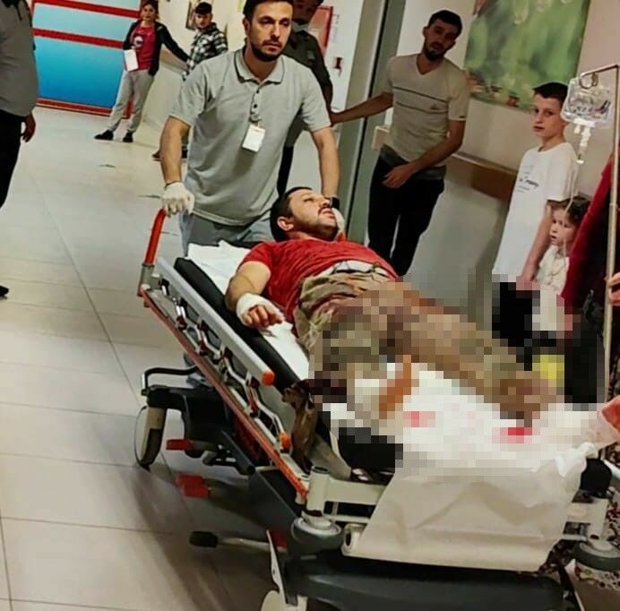Odun Keserken Elini Bacağın Kesti2