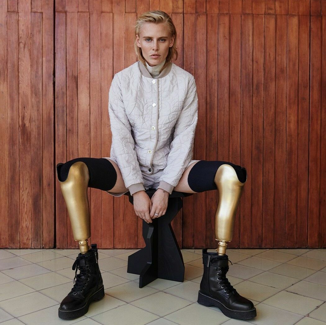 Tampon Kullanan Model Ölümden Döndü Bacaklarını Kaybetti2