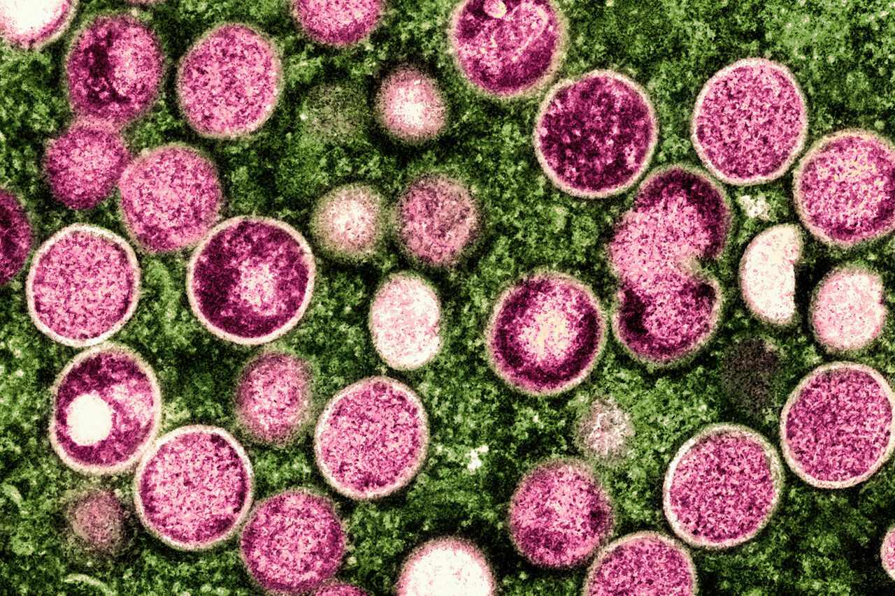 Prof. Dr. Ahmet Saltık'tan Bakanlığa Maymun Çiçeği Çağrısı 3