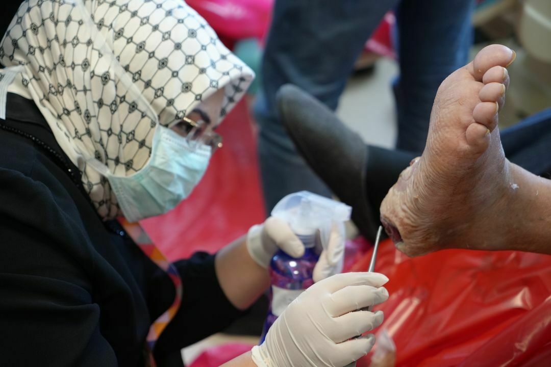 Sinek Larvaları Ile Yaraları Tedavi Ediyorlar  2