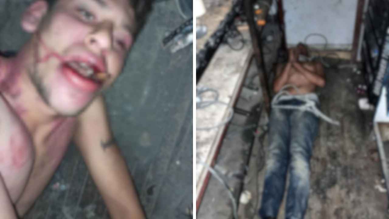 Antalya'da Dişleri Kırılıp Hamam Böceği Yedirildi! O Rapora İsyan Etti 3