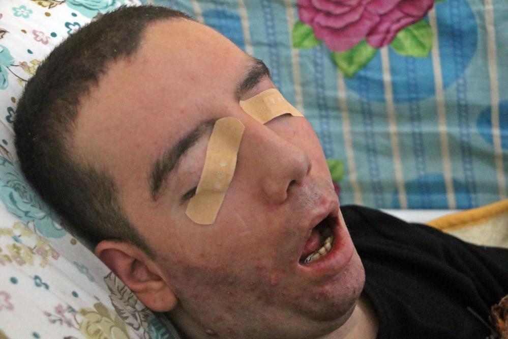 Antalya'da Yaşayan Halil 13 Yıllık Yaşam Mücadelesini Kaybetti