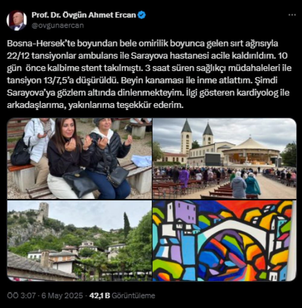 Prof. Dr. Övgün Ahmet Ercan Beyin Kanaması Geçirdi